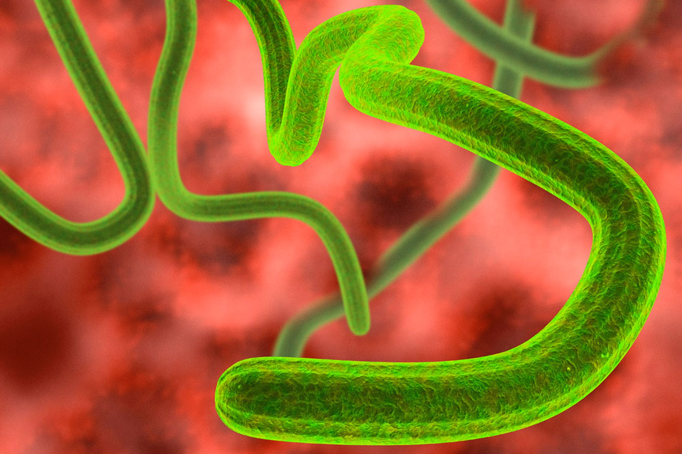 Ebola, Swine Flu, in the UK; surely not!?